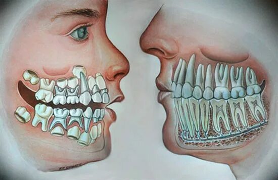 Покажи картинку как выглядят зубы Dentaltown - Where The Dental Community Lives ® Dental, Dental art, Dental anato