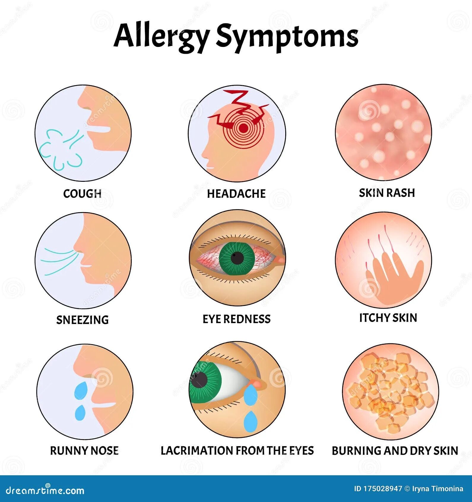 Покажите как выглядит аллергия Symptoms of Allergies Skin Rash, Allergic Skin Itching, Tearing from the Eyes, C