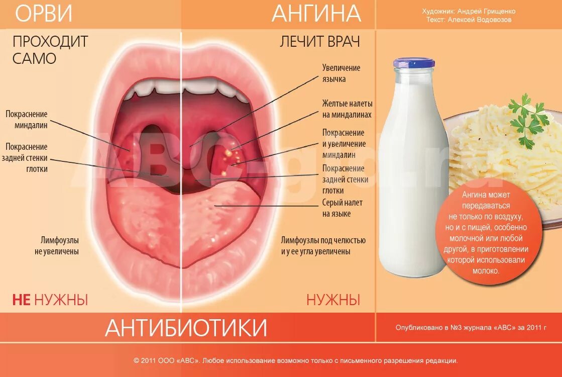 Покраснение горла у ребенка фото Итальянский стиль в интерьере Южный Город