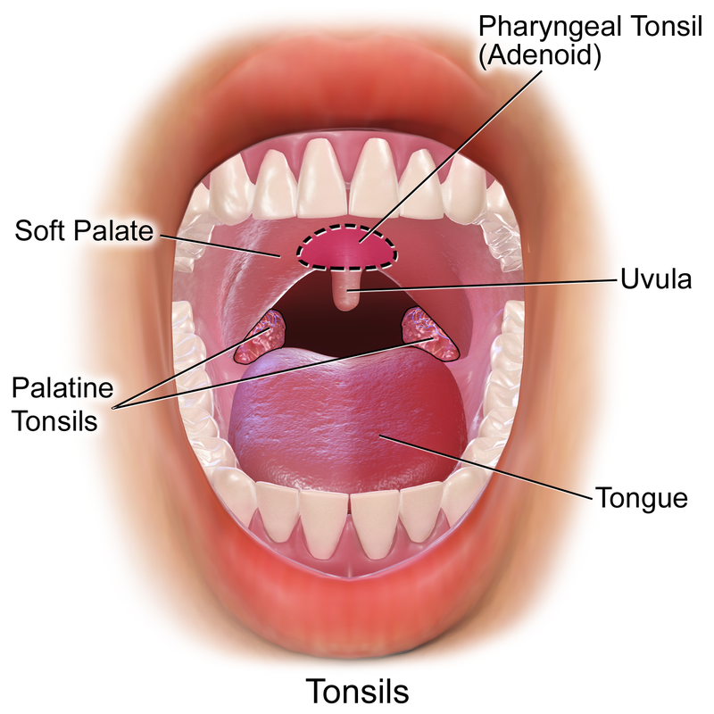 Покраснение горла у ребенка фото File:Blausen 0859 Tonsils&Adenoids.png - Wikipedia