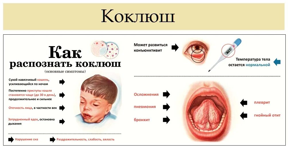 Покраснение горла у ребенка фото коклюш