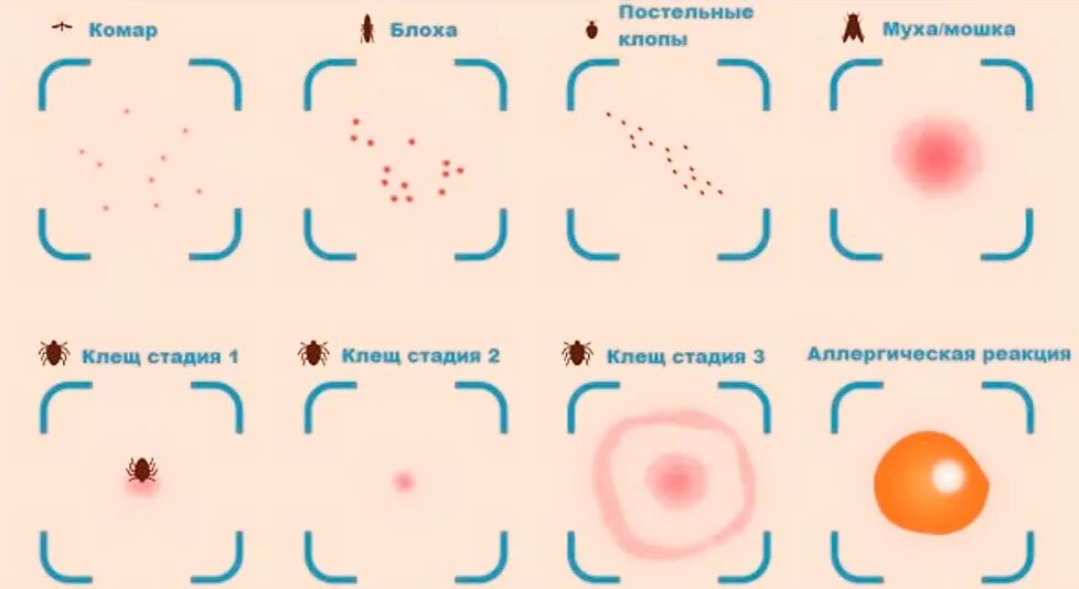 Покраснение после укуса клеща у человека фото Укус клеща - фото, симптомы, последствия