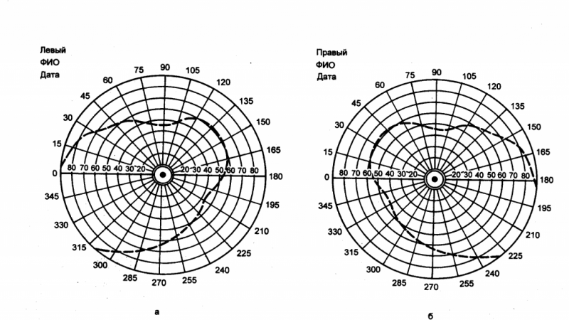 Поле зрения фото Исследование поля зрения