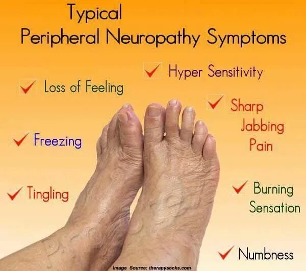 Полинейропатия нижних конечностей симптомы фото Signs and Symptoms Of Neuropathy #diabetesremede Symptoms of neuropathy, Periphe