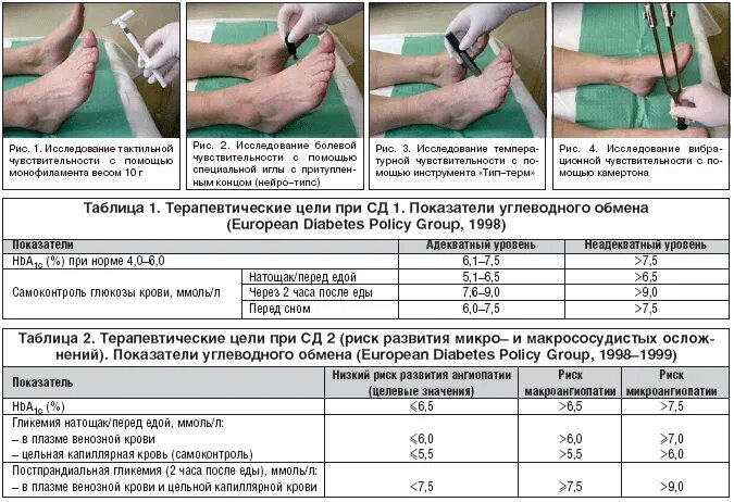 Полинейропатия нижних конечностей симптомы фото Диагностика и лечение диабетической дистальной полинейропатии у больных сахарным