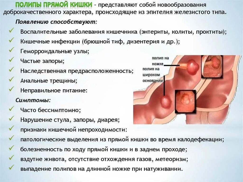 Полип как выглядит фото Доброкачественная мышечная опухоль