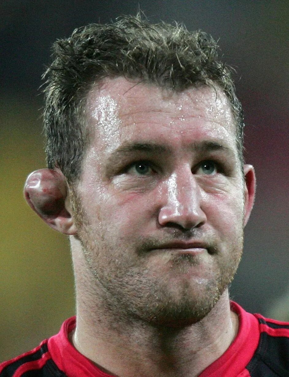 Поломанные уши у борцов фото The worst ears in rugby - Mirror Online