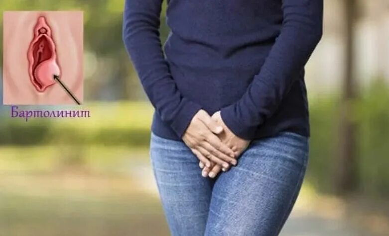 Половые губы снаружи фото Pain in the perineum in women :: Symptoms, causes, treatment.