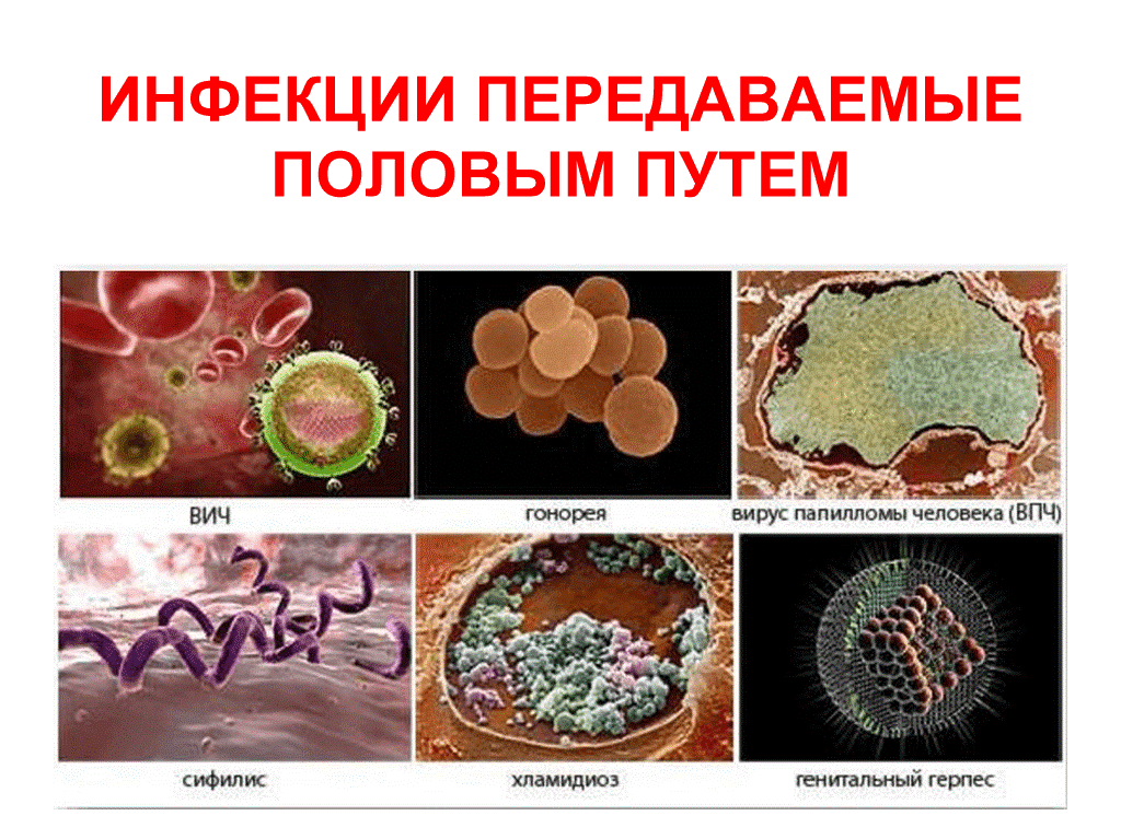 Половые инфекции у мужчин симптомы фото Лечение ЗППП у мужчин в частной клинике в Видном