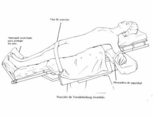 Положение тренделенбурга что это такое фото Положение тренделенбурга на операционном столе - Дом Мебели.ру