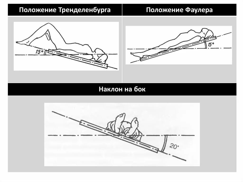 Положение тренделенбурга что это такое фото Инновационные методы в хирургии - презентация онлайн