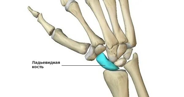 Полулунная кость фото Перелом ладьевидной кости кисти