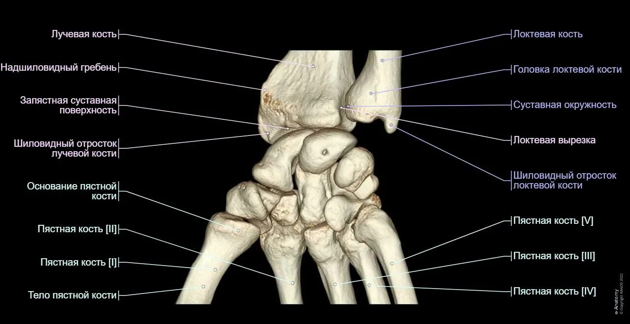 Полулунная кость кисти фото Анатомия запястья (МРТ): нормальная анатомия e-Anatomy