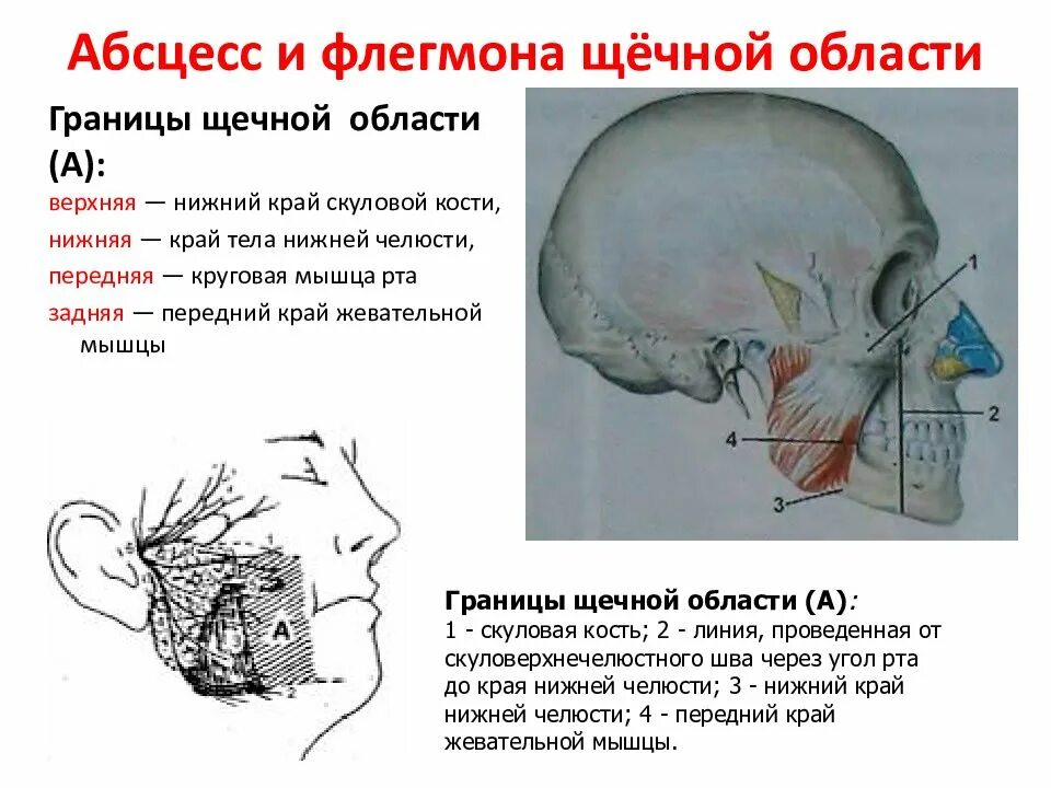 Ползучая флегмона при герпесе фото Абсцессы и флегмоны, прилегающие к верхней челюсти - презентация