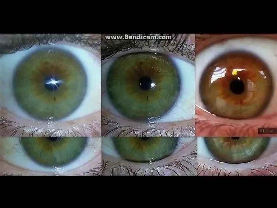 Поменять цвет глаз на фото The man that changed his eyes from brown to blue using fruit and herbs 2016 Eye 