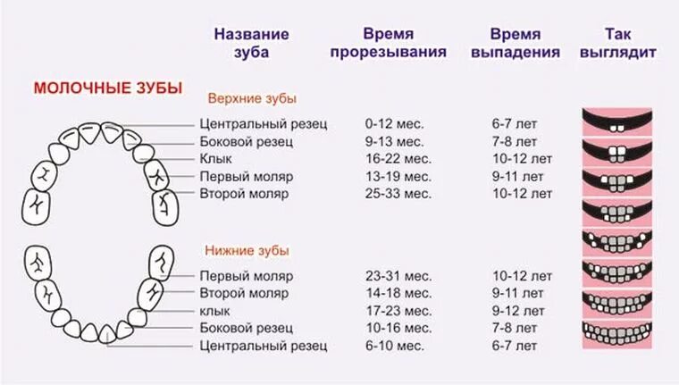 Поочередность прорезывания зубов у детей схема фото Порядок прорезывания зубов у детей. Режутся зубки: симптомы, признаки у грудничк