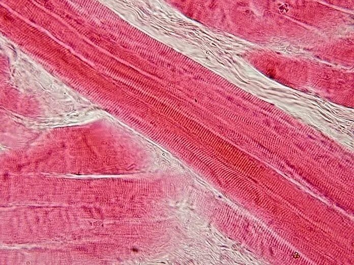 Поперечно полосатая мышечная ткань фото File:Skeletal muscle - longitudinal section.jpg - Wikipedia