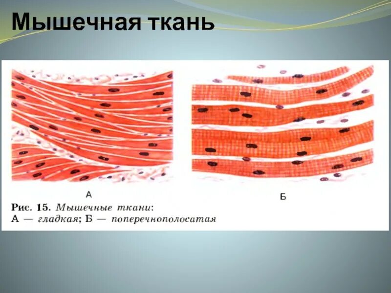 Поперечно полосатая мышечная ткань фото Скелетная поперечнополосатая мышечная ткань орган