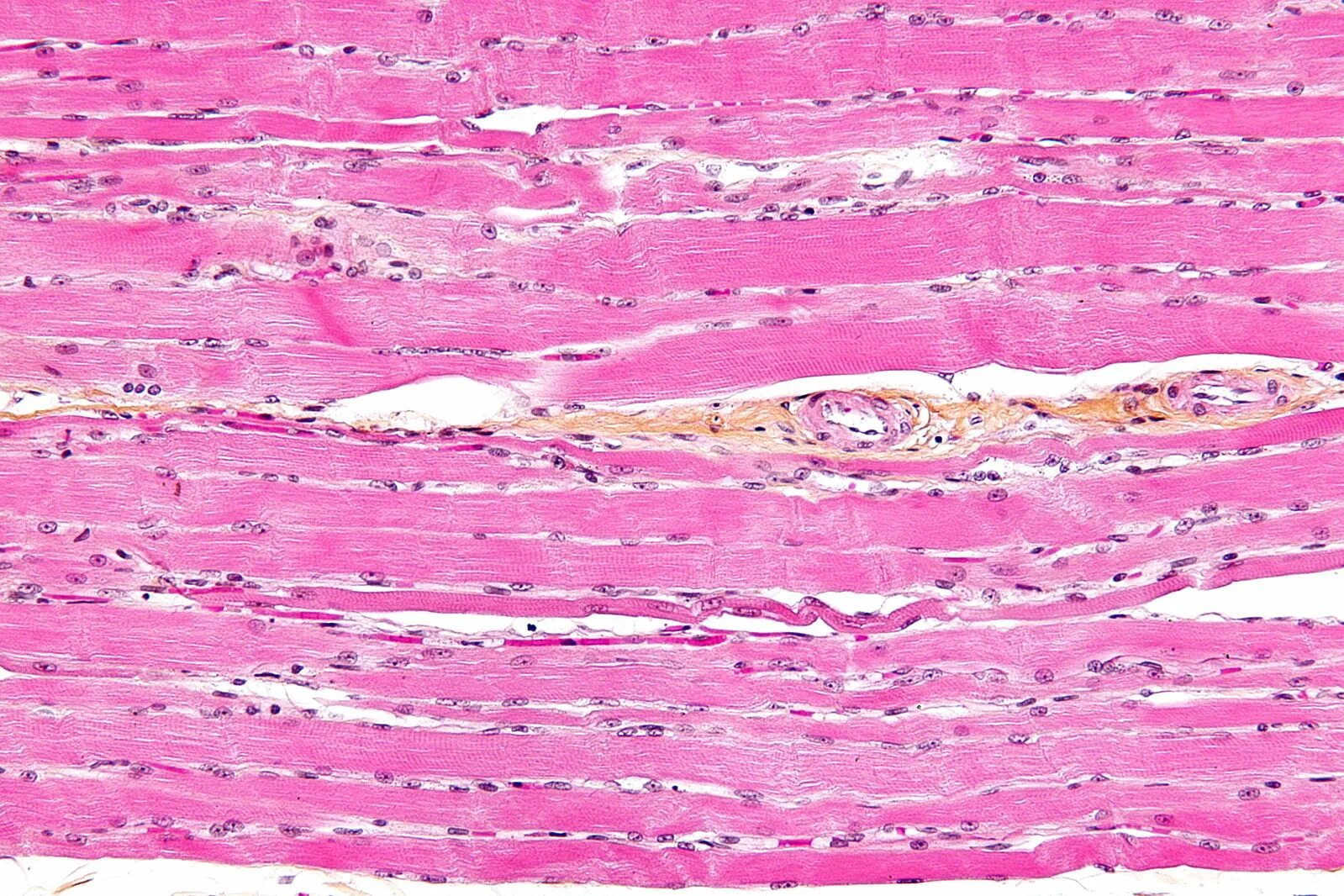 Поперечно полосатая мышечная ткань фото под микроскопом File:Skeletal striated muscle.jpg - Wiktionary, the free dictionary