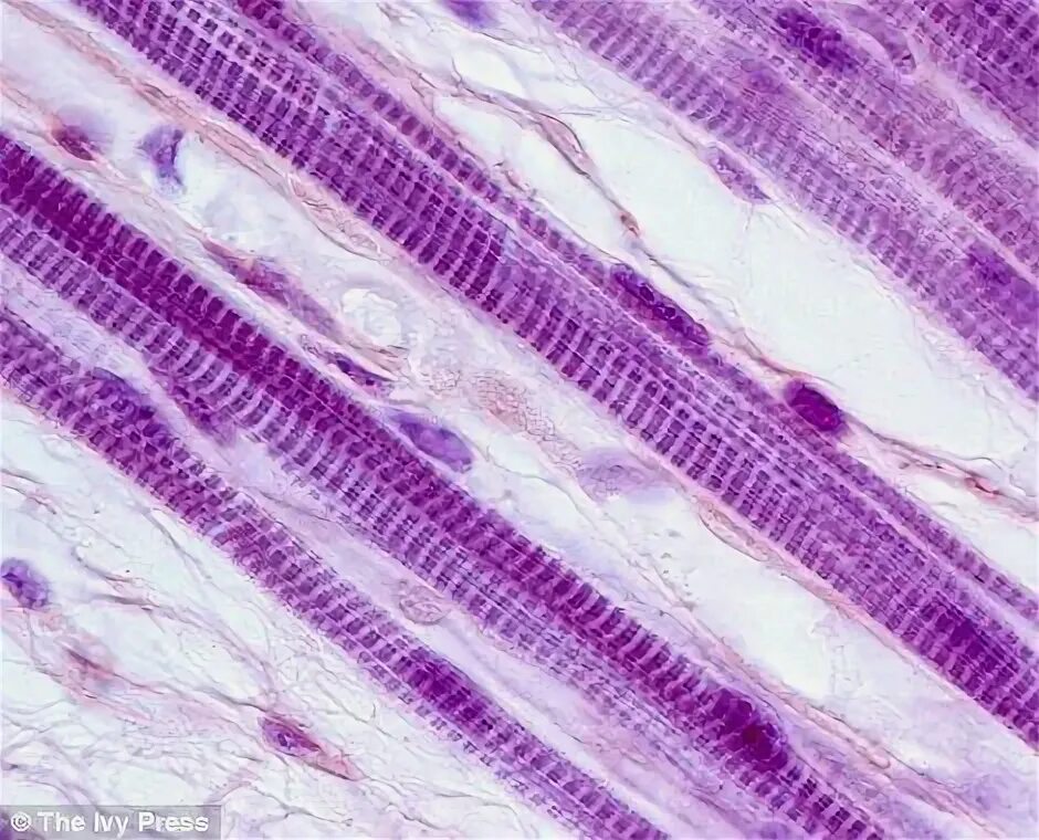 Поперечно полосатая мышечная ткань фото под микроскопом Pin on microscopico