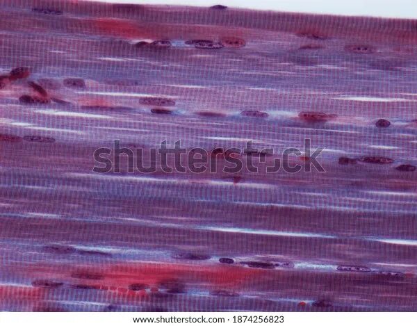 Поперечно полосатая скелетная ткань фото Skeletal Muscle Fiber: Over 739 Royalty-Free Licensable Stock Photos Shutterstoc