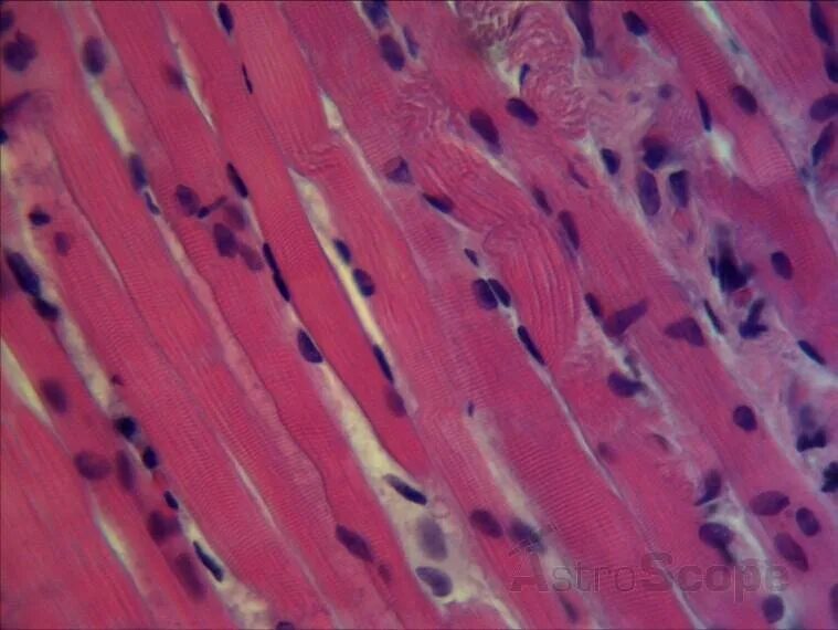 Поперечнополосатая мышечная ткань фото Статины и мышечные боли Кардиолог Константин Крулёв Дзен