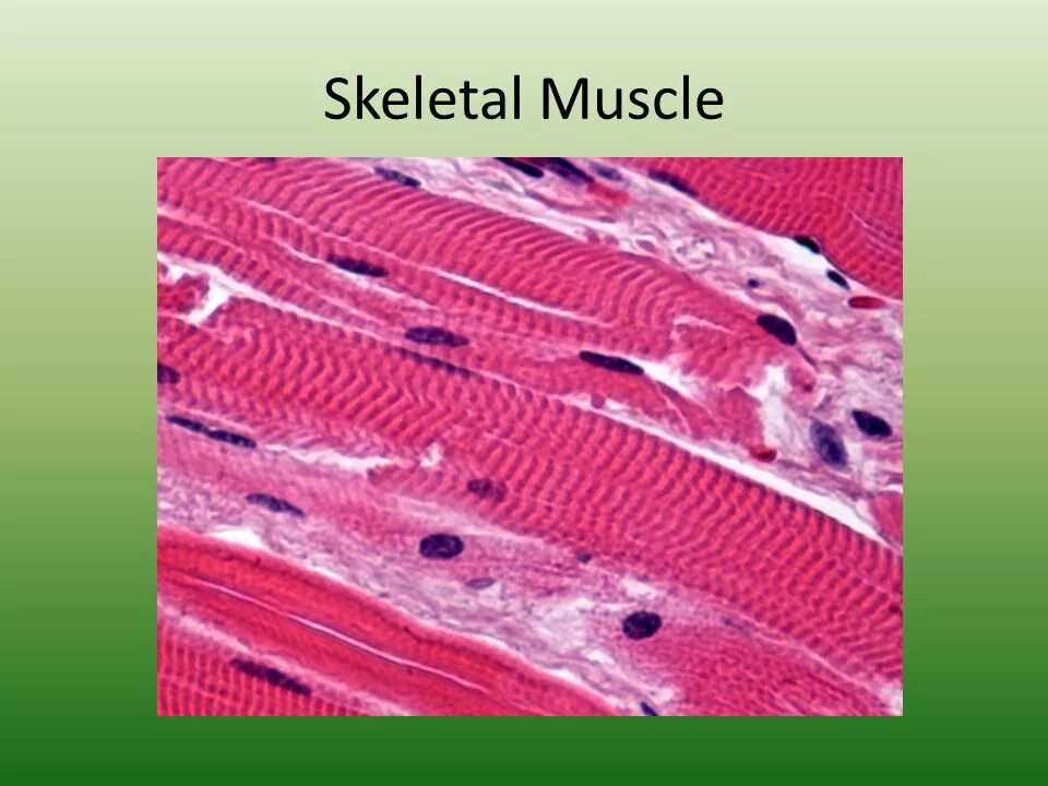 Поперечнополосатая мышечная ткань фото Поперечно полосатая ткань скелетных мышц: найдено 85 картинок