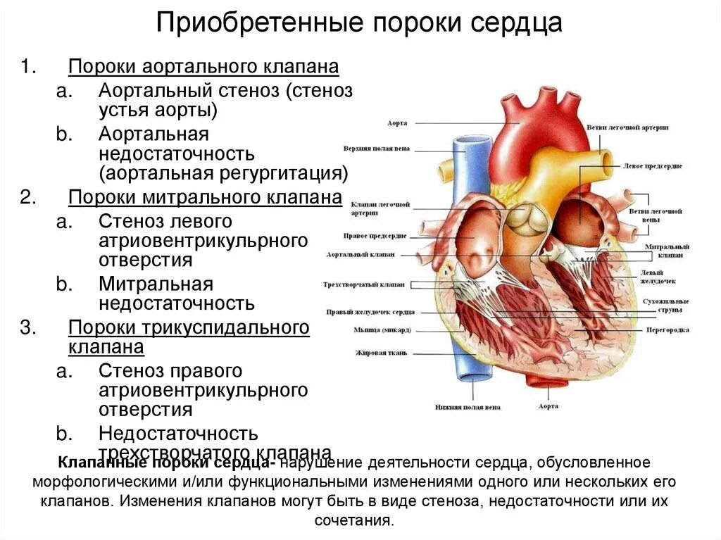 Порок сердца фото Приобретенные пороки развития сердца