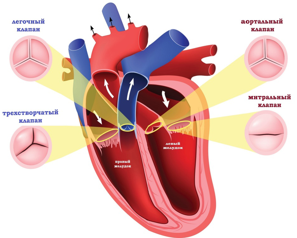 Порок сердца фото Врожденный порок сердца клапаны