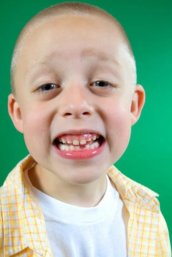 Посеребренные зубы у детей как выглядят Kid missing tooth stock photo. Image of enjoyment, shirt - 7648442