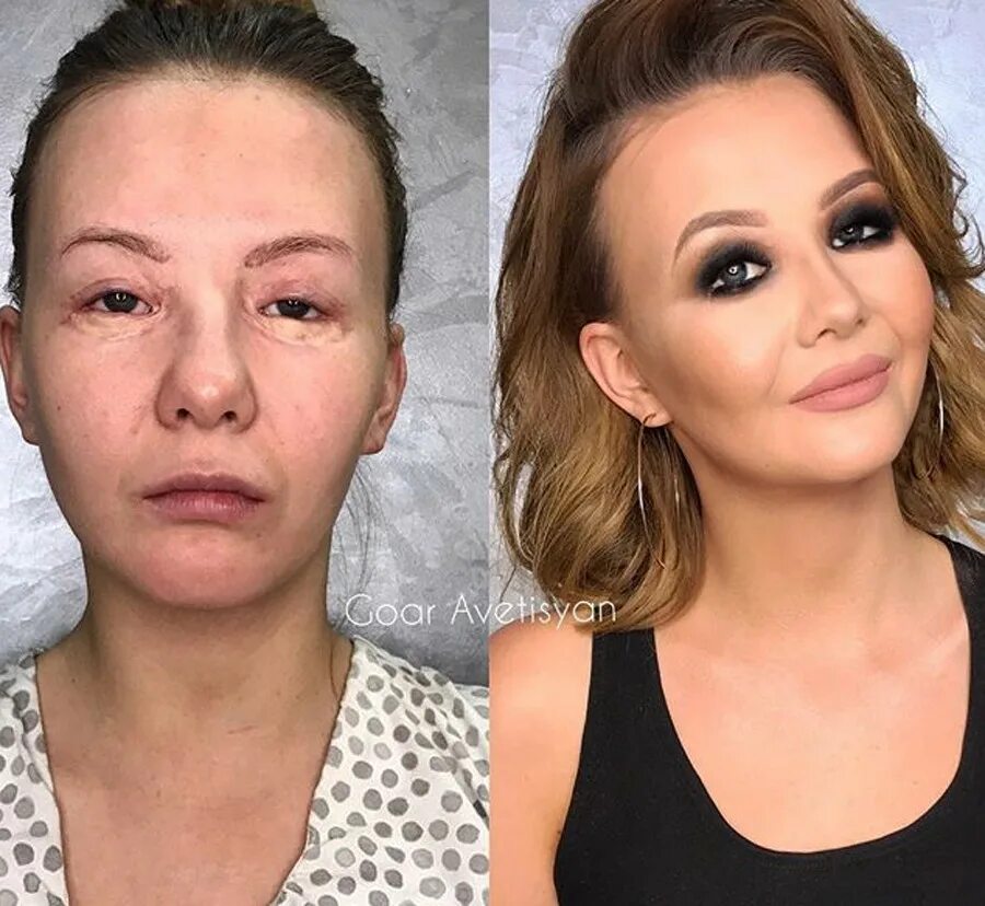 После макияжа болят глаза How a makeup artist from Moscow helps women with cancer and skin conditions - Ru