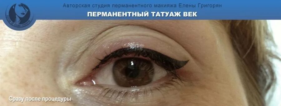 После татуажа глаз Татуаж век: последствия, которые можно ожидать