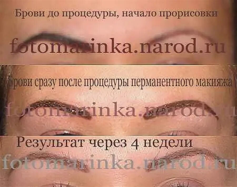 После татуажа сколько нельзя мочить Фото как сходит татуаж бровей: сроки, последствия и осложнения после процедуры -