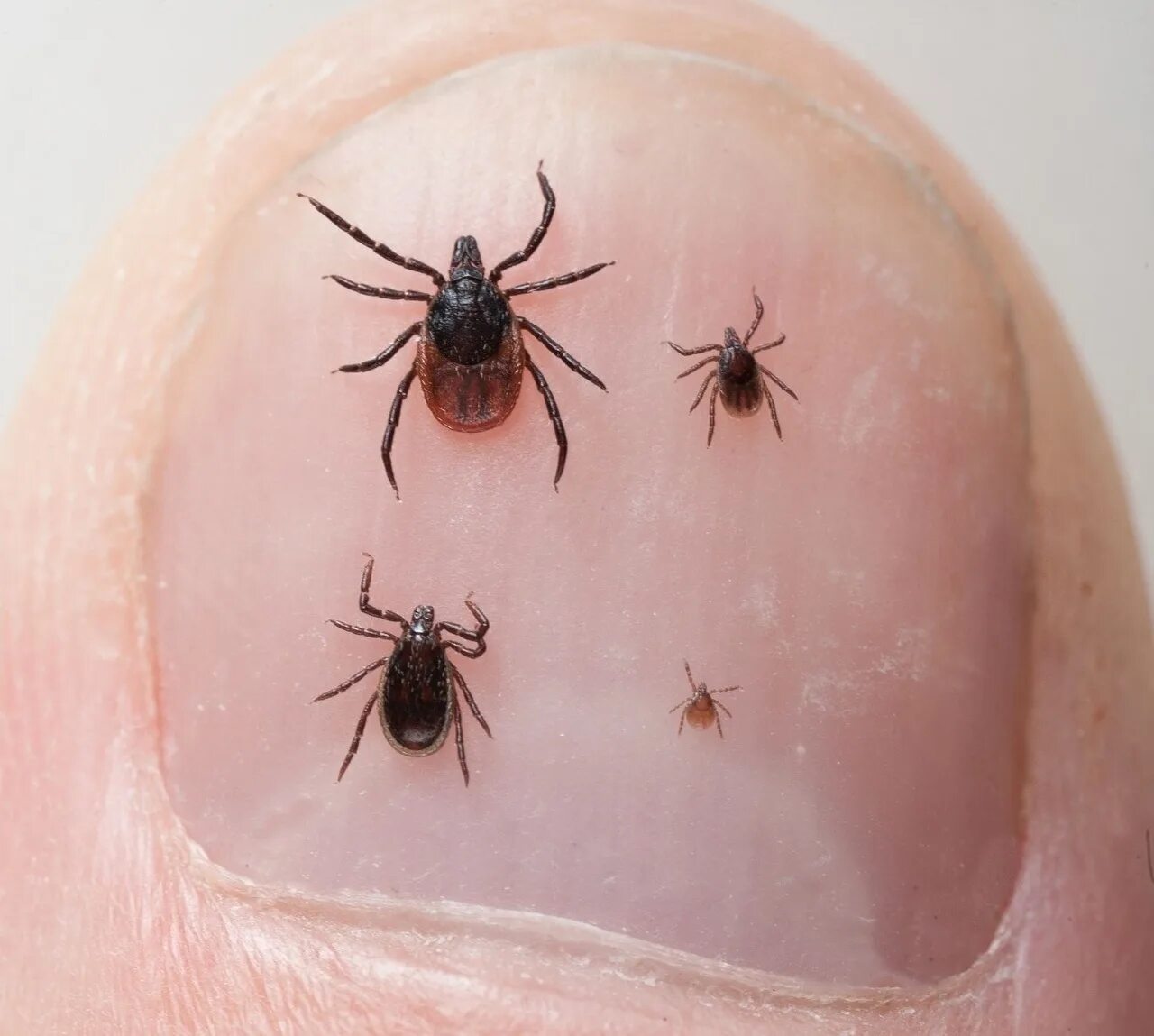 После укуса клеща красное пятно фото 963 people suffered from tick bites in the Nizhny Novgorod region. Bites were re