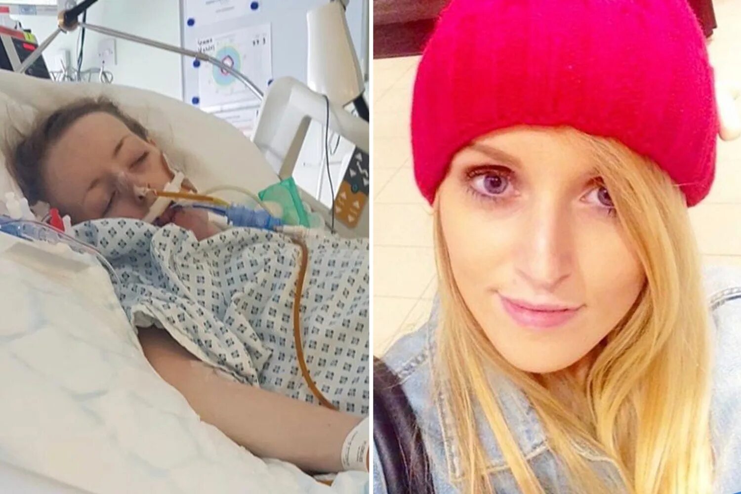 Последнее фото началовой в больнице Healthy woman, 29, left paralysed and in coma for five days after contracting se