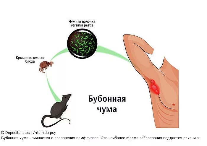 Последняя стадия чумы фото Почему чуму не удается полностью уничтожить на планете