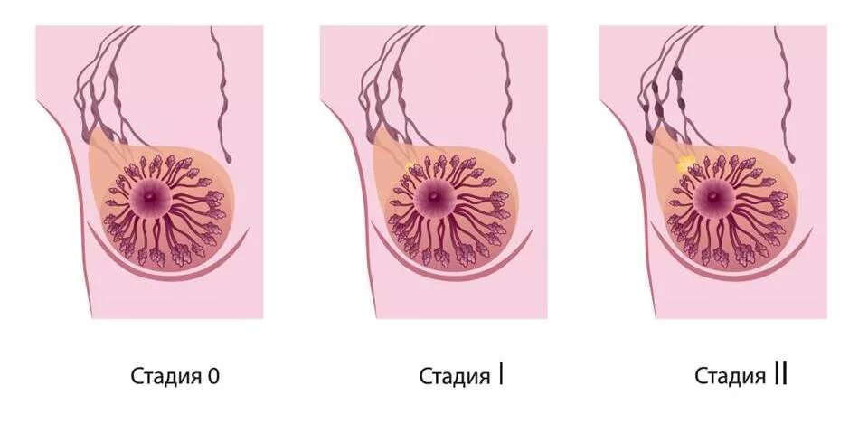 Онкология (лечение рака) в Краснодаре - клиника "Здрава"