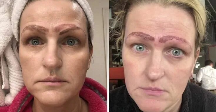 Последствии татуажа Mujer se somete a microblading barato y termina con cuatro cejas Permanent makeu