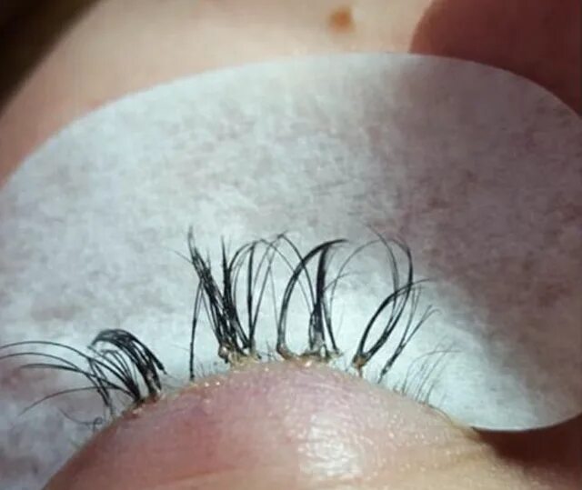 Последствия наращивания фото Beauty expert issues warning after woman’s eyelash extensions cause her real one