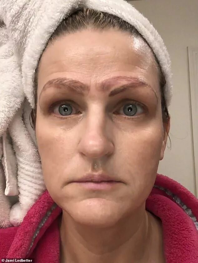 Последствия перманентного макияжа Woman is DUMPED after botched microblading left her with four eyebrows Permanent