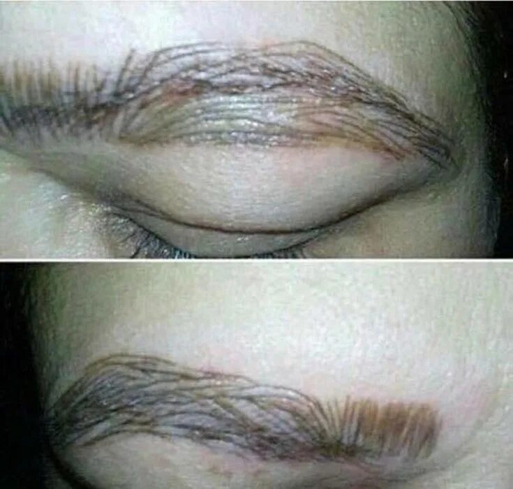 Последствия перманентного макияжа бровей Viral post highlights the reality of going to a REALLY bad eyebrow salon Bad eye