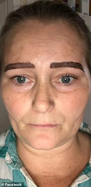 Последствия перманентного макияжа фото Woman shares horrifying images of her botched microblading procedure Daily Mail 