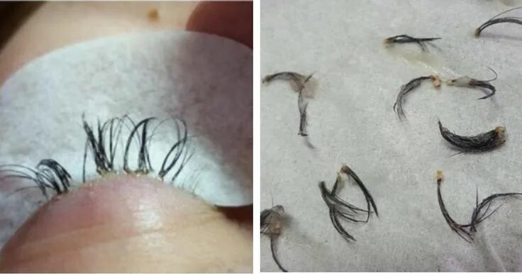 Последствия после наращивание ресниц фото Une professionnelle de la beauté lance un appel au sujet des extensions de cils!