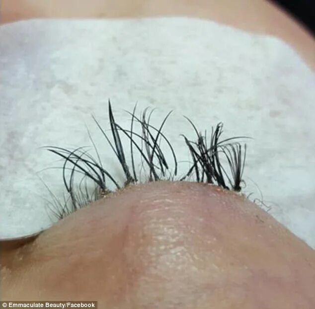 Последствия после наращивание ресниц фото Beauty professional warning after eyelash extension job Daily Mail Online