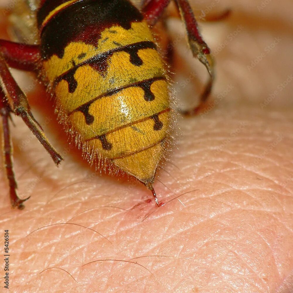 Последствия укуса осы фото Hornissen ( Vespa crabro )2 фотография Stock Adobe Stock