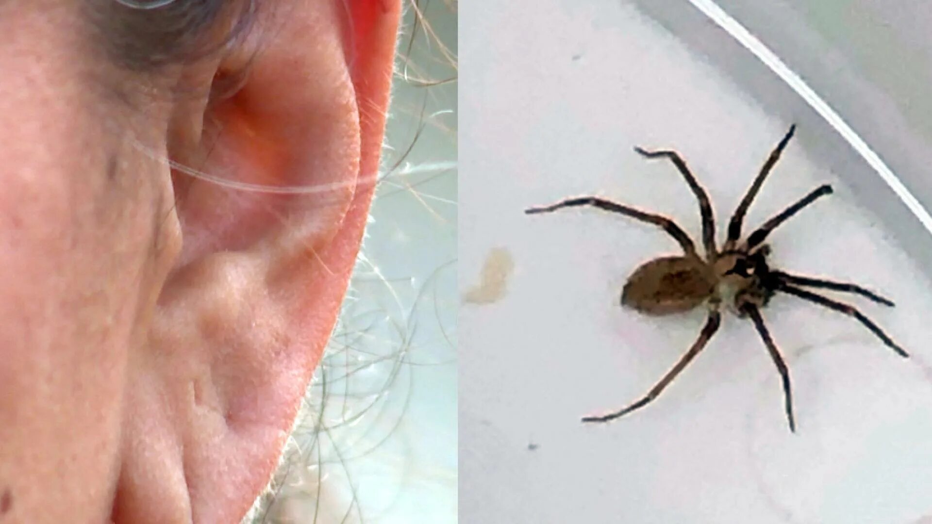 Последствия укуса паука фото Brown recluse spider found in woman's ear