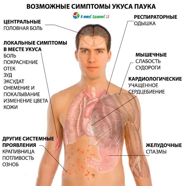 Последствия укуса паука фото Укусы пауков: симптомы и лечение