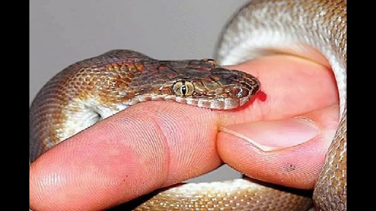 Последствия укуса змеи фото Snake rescuer bitten by venomous cobra lives to tell the tale - YouTube