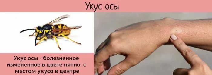 Последствия укусов фото Укусы насекомых у детей: помощь до и после