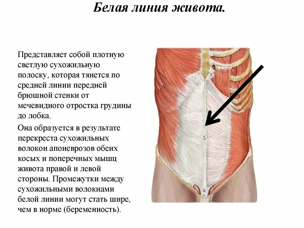 Послеоперационные фото грыжи белой линии живота Слабая передняя брюшная стенка живота